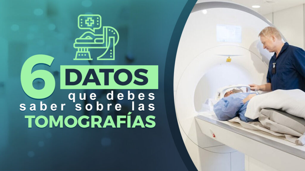cabezote tomografia